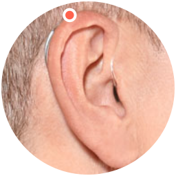 Das Bild zeigt die Position der Mikrofone an einem Hinter dem Ohr Hörgerät. Diese befinden sich nämlich deutlich weiter oberhalb.