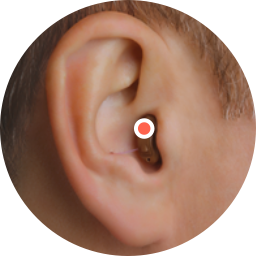 Das Bild zeigt die Position des Mikrofons bei einem Im Ohr Hörgerät. Das Mikrofon sitzt direkt im Gehörgang